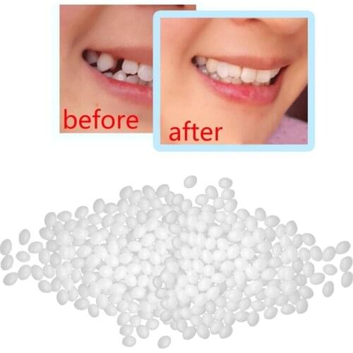 Teeth And Gap Falseteeth Solid Glue Resin Denture Adhesive Teeth Dentist Falseteeth Solid Glue Temporary Tooth Repair Set #W2