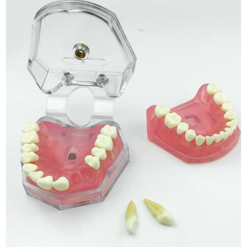 Dental Teaching Model Removable Teeth Soft Gum ADULT TYPODONT Model Dental Supplies