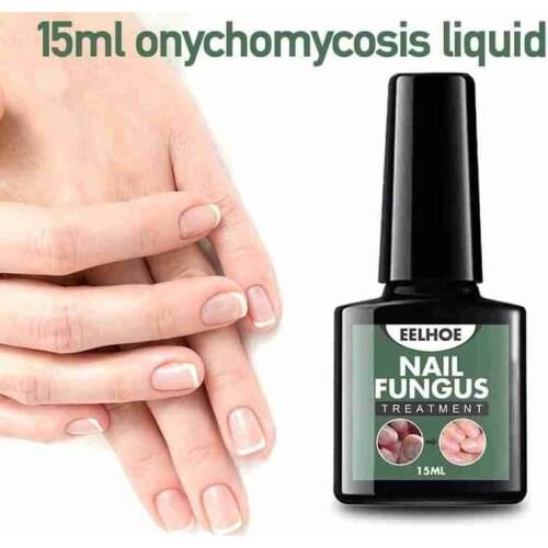 Fungal Nail Treatment Serum Nail Foot Nail Fungus Removal Gel Fungal Nail Repair Serum Anti Infection Onychomycosis Nail Repair