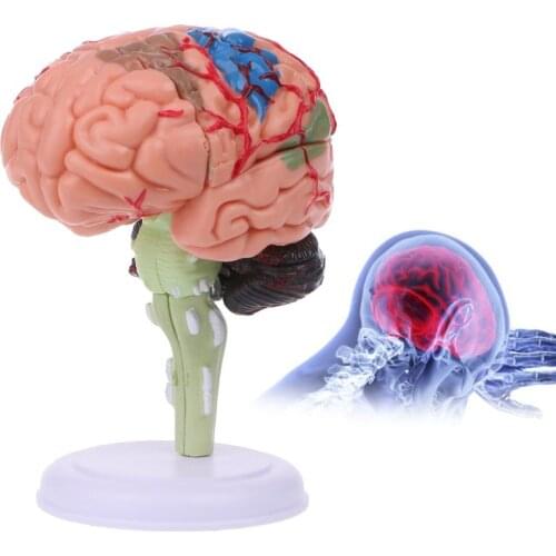 4D Disassembled Anatomical Brain Human Model Anatomy Medical Teaching Tool Statues Sculptures Medical School Use