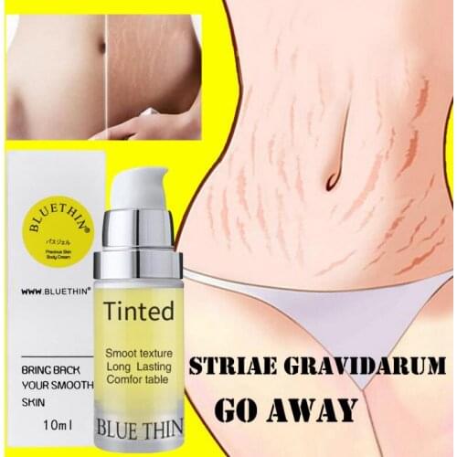 2pcs 10ml Repair Cream Removal Fade Stretch Marks Scar Obesity Pattern Growth Pattern Gel Nourishing Maternity Body Skin Care