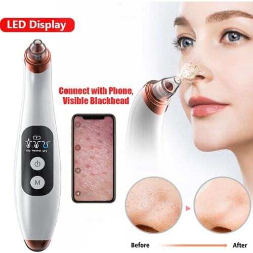 Blackhead Remover Face Deep Nose Cleaner T Zone Pore Acne Pimple Removal Vacuum Suction Facial Diamond Beauty Clean Skin Tool