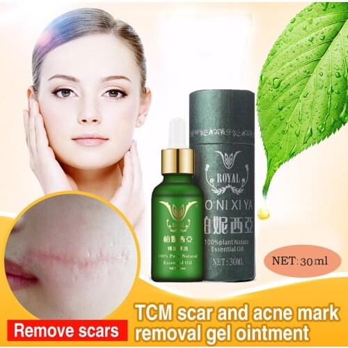 Face Care Essential Oil Acne Scar Spots Removal Skin Care Whitening Remove Scars Acne Repair Face Cream Essence Acne Treatment