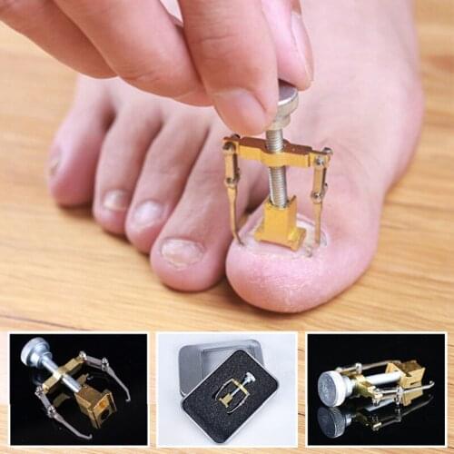 1PC Ingrown Toe Nail Recover Tool Pedicure Toenail Fixer Pedicure Foot Nail Care Ingrowing Nail Onyxis Bunion Corrector for Toes