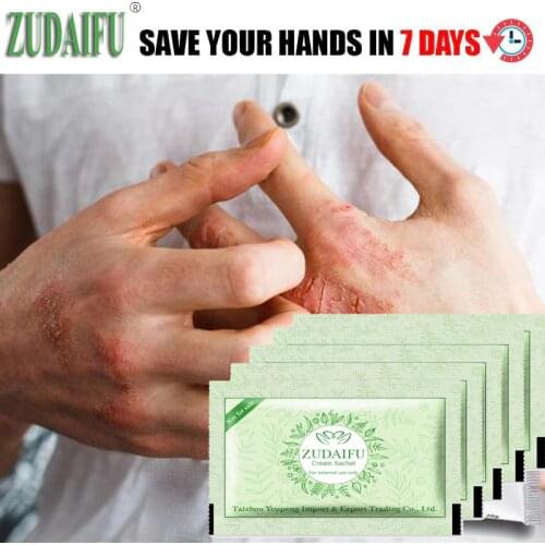 5Pcs/Lot zudaifu Body Psoriasis Ceam China Creams Psoriasis Ointment Massage Cream