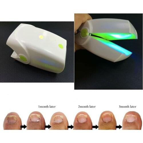 Highly Effective Rechargeable Nail Fungus Laser Treatment Device Nail Infection Onychomycosis Cure Nail Fungal Infections