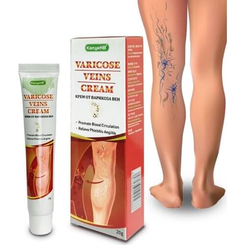 1pcs 20g ointment effective treatment of varicocele in the scrotum Leg Varicose Veins Treatment Cream