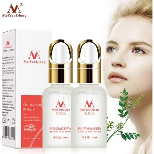 2pcs Centella Asiatica Acne Removing Essence Serum Remove Acne To Eliminate Acne Marks And Control Oil To Enhance Whiten Skin