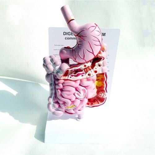 Human digestive system Anatomical model colorectal, duodenal, viscera and stomach Anatomical structure model