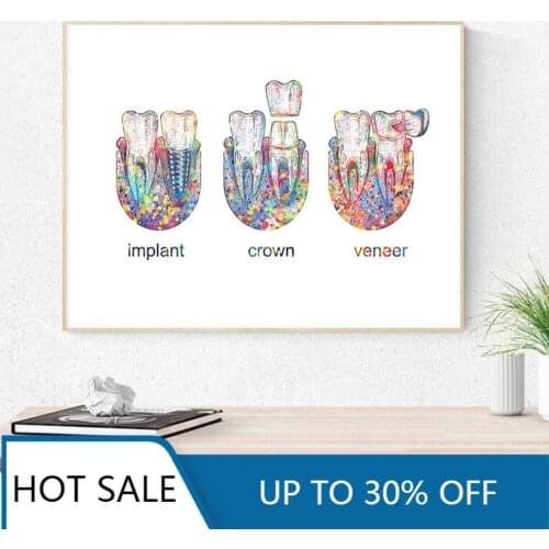 Tooth Implant Wall Art Canvas Painting Posters Prints Dental Crown Dentist Gift Tooth Anatomy Medical Dental Clinic Room Decor
