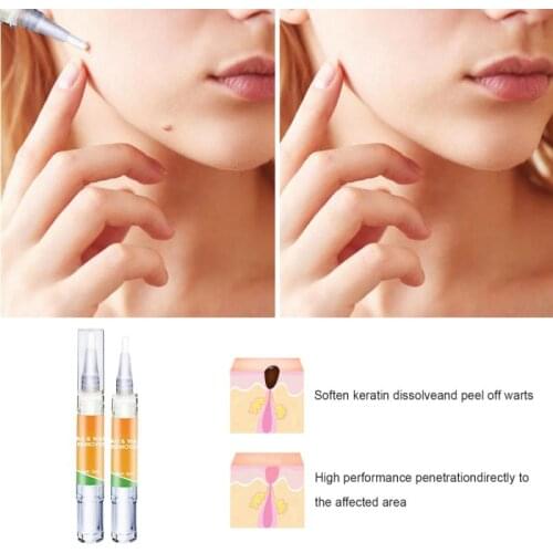 Skin Tag Cure Removal Body Mole Wart Remover Spot Marks Remover Treatment Painless Body Care Skin Care For Pedicure TSLM1