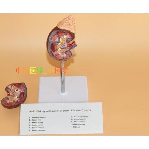 Free shipping kidney Anatomical Model Urology 23*10.5*6.5cm