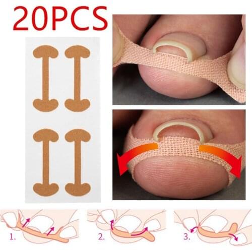 20pcs Professional Embedded Toe Nail Corrector Sticker Toenail Care Pedicure Thumb Curl Correction Sticker