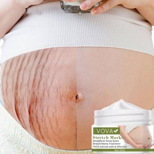 Remove Pregnancy Scars Acne Cream Stretch Marks Cream Treatment Maternity Repair Anti-Aging Anti-Winkles Firming Body Creams