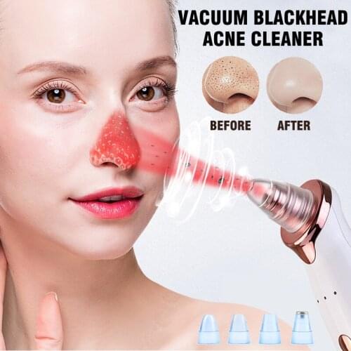 Electric Blackhead Vacuum Cleaner Deep Sucking Face Acne Pimple Pore Cleanser Blackhead Remover Facial Beauty Device Women Men