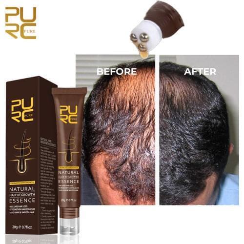PURC Natural Essence For Hair Growth Oil Scalp Massage Treatments Hair Loss Remedy Ginger Grow Hair Products Care For Women Men
