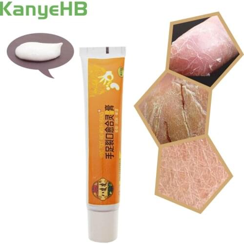 1Pcs Natural Ointment Oil Anti-Drying Crack Foot Cream Powerful Heel Cracked Repair Cream Removal Dead Skin Hand Feet Care S012