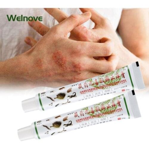 20g Eczema Cream Treat Dermatitis Psoriasis Antipruritic Ointment Antibacterial Anti Itch Chinese Medical Plaster Skin Care