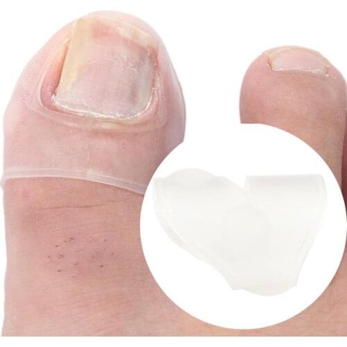 2Pcs Silicone Elastic Patch Nail Ingrown Correction Sticker Toenail Tool Stretchable Reusable Curved Toenails Patch for Elder