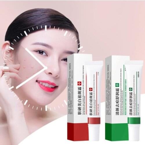 Effective Whitening Freckle Cream Remove Dark Spots Anti-acne Anti Freckle Cream Fade Pigmentation Brighten Creams Skin Care