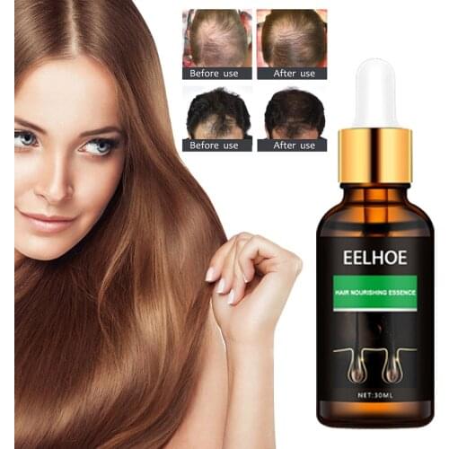 Ginger Hair Growth Essences For Hair Germinal Hair Growth Serum Essences Oil Hair Loss Treatment Growth Olive Oil For Hair TSLM2