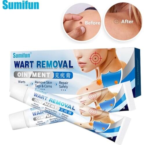 1Pcs 20g Skin Tag Remover Ointment Fast Remove Foot Corn Warts Papillomas Moles Wart Treatment Cream Herbal Medical Plaster