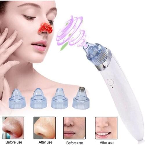 Electric Vacuum Pore Cleaner Pro Blackhead Vacuum Suction Acne Clean Exfoliating Cleansing Comedo Suction Pore Cleaner