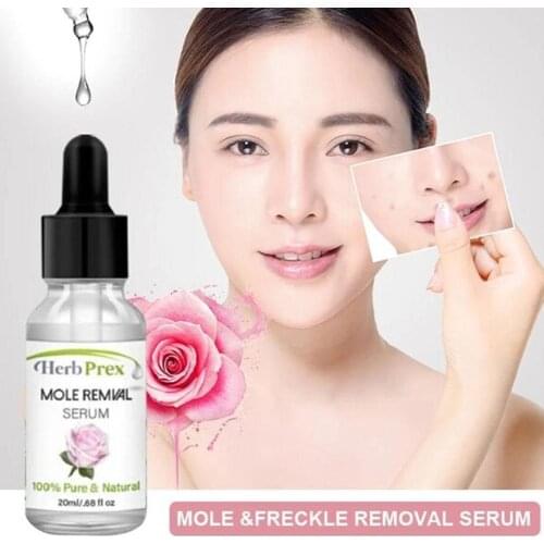 Removal Mole Essential Oil Reduce Melanin Black Spots Liquid Vitality Mole Dilute 20Ml Wart Serum Restore Skin Moles L5V2