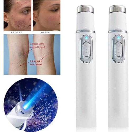 Blue Light Acne Therapy Laser Pen Soft Scar Wrinkle Removal Treatment Device Skin Care Beauty Equipment