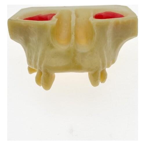 Dental Sinus Lift Practice Teeth Model Typodont Study Model 2013F
