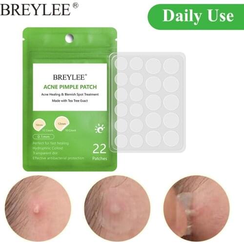 BREYLEE 0.1mm Acne Pimple Patch Stickers Daily Use Invisibility Acne Peeling Treatment Pimple Remover Tool Blemish Spot Mask New