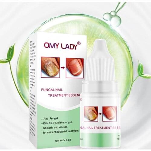 10ml Anti Fungal Treatment Nail Nail Fungus Treatment For Onychomycosis Paronychia Infection Herbal Toe Finger Nails Care