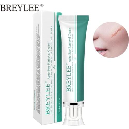 BREYLEE Acne Scar Removal Cream Face Cream Skin Repair Skin Care Scar Acne Treatment Remove Stretch Marks Whitening Cream 30g
