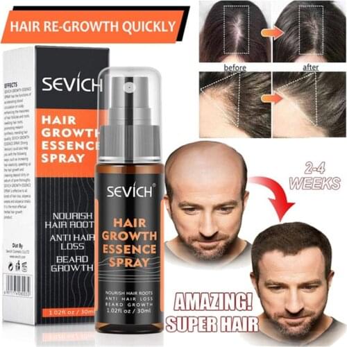 Sevich 30ml Hair Loss Treatment Preventing Hair Growth Hair Products Beauty Products Hair Growth Oil for Black Women Beauty