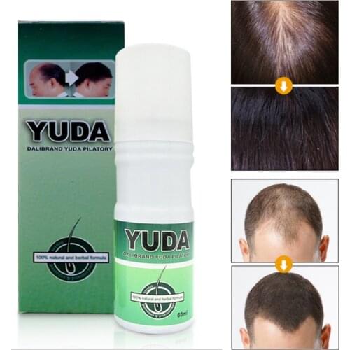 3pcs Original YUDA sterile liquid hair prevent package scalp hair care hair growth fluid Anti-hair loss Products