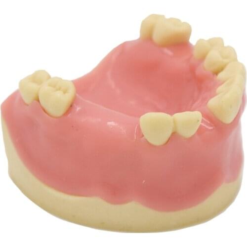 Denture Dental materials oral implant practice Suture teaching model Maxillary missing tooth implant
