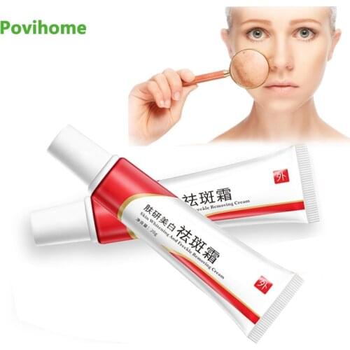 1Pcs 20g Face Whitening Freckle Cream Remove Freckles Dark Spots Whiten Moisturizing Ointment Chinese Herbal Medical Plaster