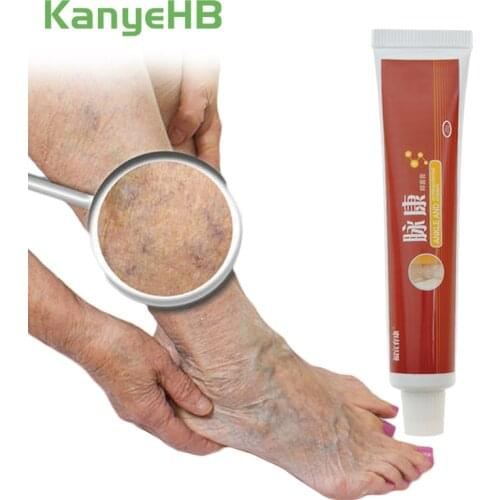 1pcs Treatment For Varicose Veins Chinese Herbal Medicine For Varicosity Angiitis Removal Phlebitis Leg Veins Pain Ointment S034