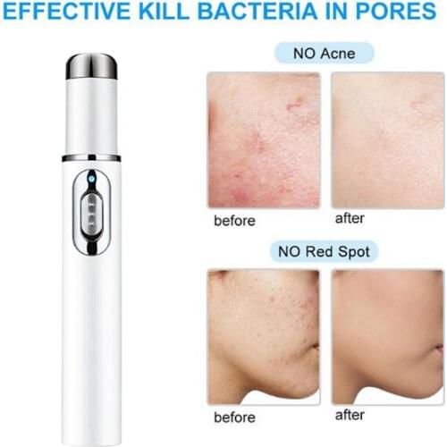 KD-7910 Blue Light Acne Pen Soft Scar Wrinkle Removal Treatment Eraser Device Portable Massage Relax