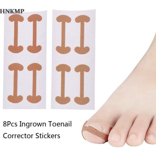 8Pcs Toenail Stickers Toenail Correction Tool Ingrown Toe Nail Treatment Toenail Straightening Sticker for Home Shops