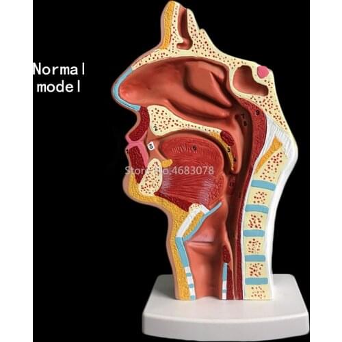 Normal/pathological Anatomy model of the nasopharyngeal cavity in the nasal cavity and throat of human body 24x12x12cm