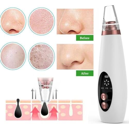 USB Rechargeable Blackhead Remover Face Vacuum Skin Care Acne Pore Cleaner Pimple Removal Suction Facial Tools #TD-153