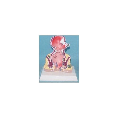 Human rectum Dissection human organs Anatomy model free shipping