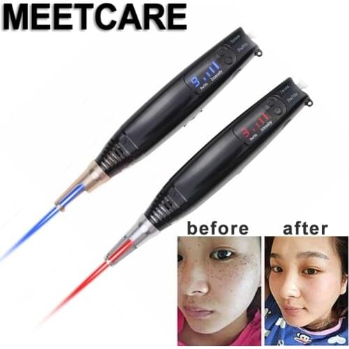 Picosecond Laser Pen Blue Red Light Therapy Pigment Tattoo Scar Mole Freckle Removal Dark Spot Remover Machine Laser Pigment Pen