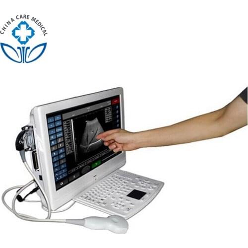 18 inch large LCD and touch screen Ultrasound scanner