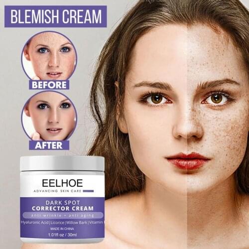 30ML EELHOE Nourishing Moisturizers Safe Compact Dark Spot Corrector Cream for Ladies