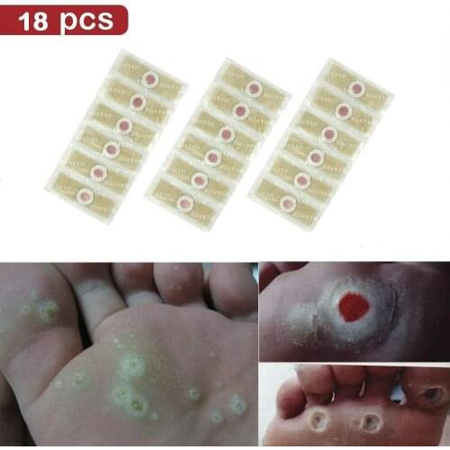 18pcs/lot Relieve Pressure Patch Foot Care Relief Pain Removal Warts Plaster Chicken Eye Corns Ointment Paste
