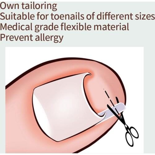 Nail Groove Special Gasket (10Pcs Gasket) Nail Correction Pad Q9B7