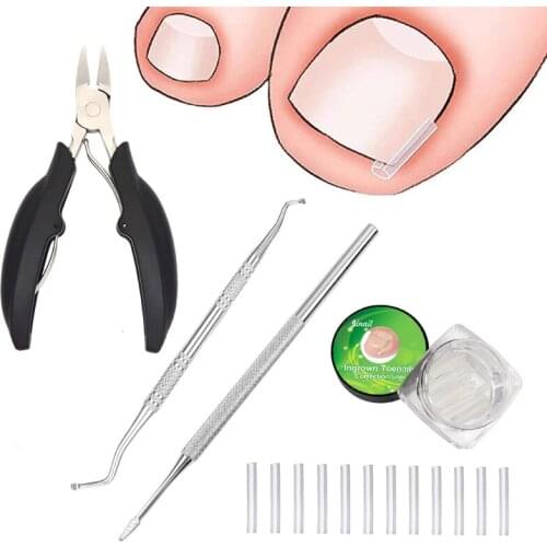 Ingrown Toenail File Lifter Non-slip Clipper Corrector Liner Stainless Steel Ingrown Toenail Tool Professional Grade C1FF