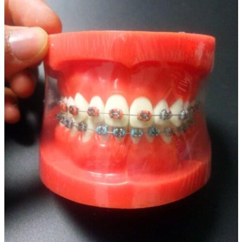 Orthodontic Dental Typodont Teeth Model with Fully Metal Bracket High Quality Dental Orthodontic Model With Teeth Brackets